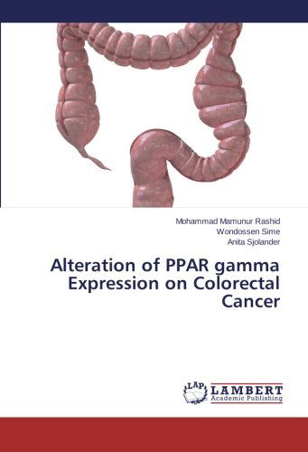 Cover for Anita Sjolander · Alteration of Ppar Gamma Expression on Colorectal Cancer (Paperback Book) (2014)