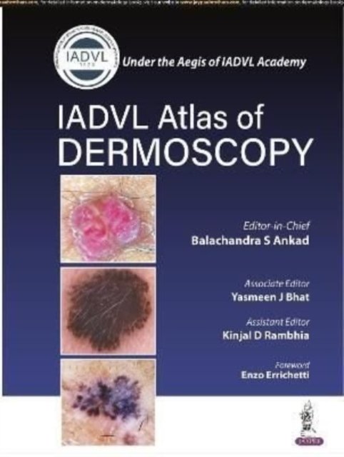 Cover for Balachandra S Ankad · Atlas of Dermoscopy (Pocketbok) (2021)