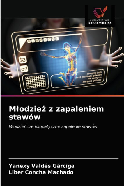 Cover for Yanexy Valdes Garciga · Mlodzie? z zapaleniem stawow (Paperback Book) (2021)