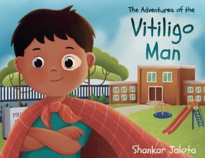 Cover for Shankar Jalota · The Adventures of The Vitiligo Man (Pocketbok) (2022)