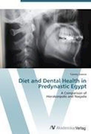 Cover for Greene · Diet and Dental Health in Predyn (Book) (2012)