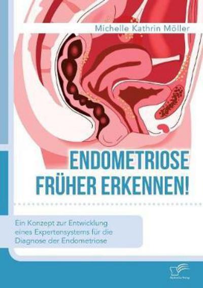 Cover for Möller · Endometriose früher erkennen! Ei (Buch) (2017)