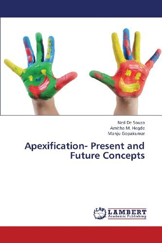 Cover for Manju Gopakumar · Apexification- Present and Future Concepts (Pocketbok) (2013)