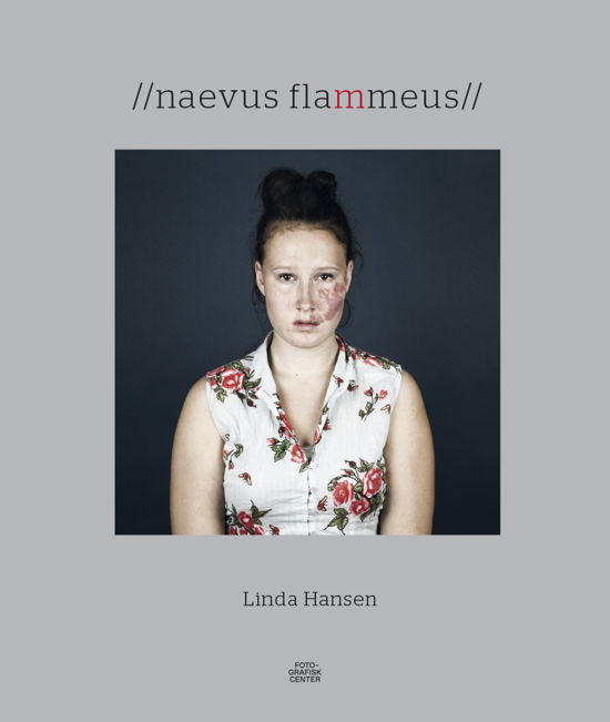 Naevus flammeus - Linda Hansen - Böcker - Fotografisk Center - 9788790362652 - 2016