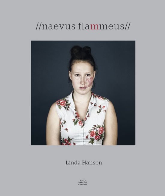 Naevus flammeus - Linda Hansen - Boeken - Fotografisk Center - 9788790362652 - 2016