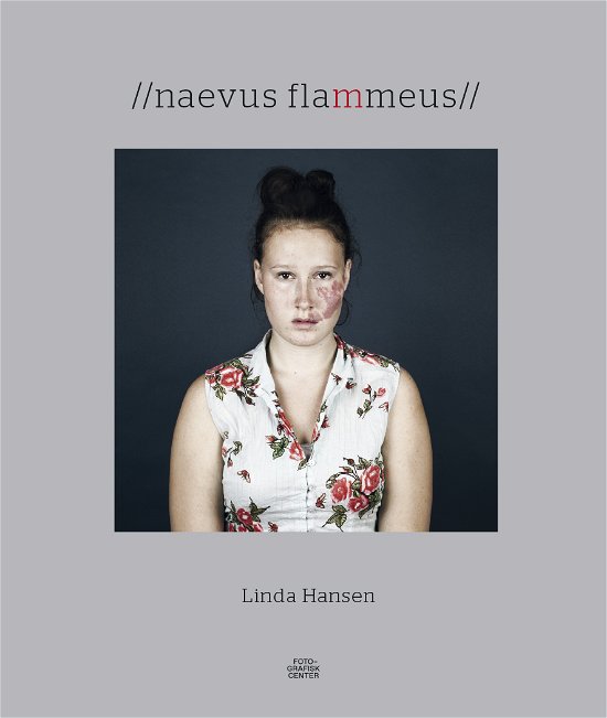 Naevus flammeus - Linda Hansen - Bøger - Fotografisk Center - 9788790362652 - 2016