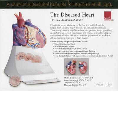 Life Size Diseased Heart Model - Scientific Publishing - Gadżety - Scientific Publishing - 9781932922653 - 19 maja 2006