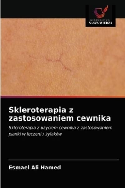 Cover for Esmael Ali Hamed · Skleroterapia z zastosowaniem cewnika (Pocketbok) (2021)