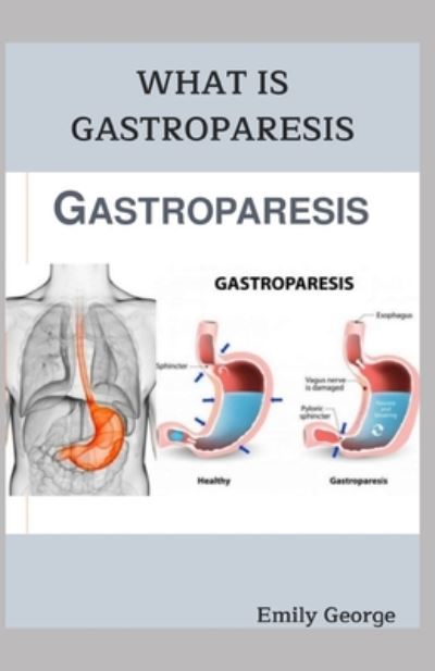 Cover for Emily George · What Is Gastroparesis (Paperback Book) (2020)