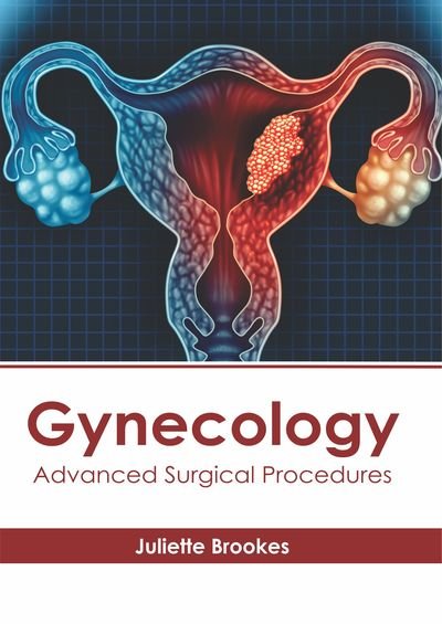 Juliette Brookes · Gynecology (Hardcover Book) (2019)