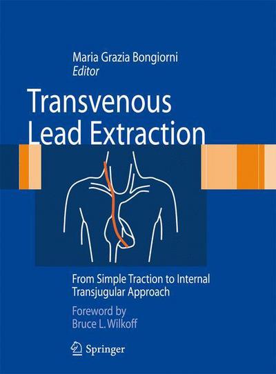 Cover for Maria Grazia Bongiorni · Transvenous Lead Extraction: From Simple Traction to Internal Transjugular Approach (Hardcover Book) [1st ed. 2011 edition] (2011)