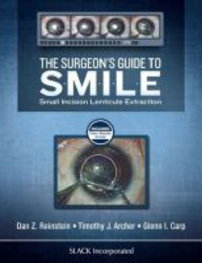 Cover for Dan Reinstein · The Surgeon’s Guide to SMILE: Small Incision Lenticule Extraction (Hardcover Book) (2018)