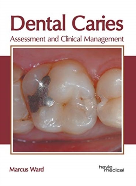 Cover for Marcus Ward · Dental Caries: Assessment and Clinical Management (Inbunden Bok) (2019)