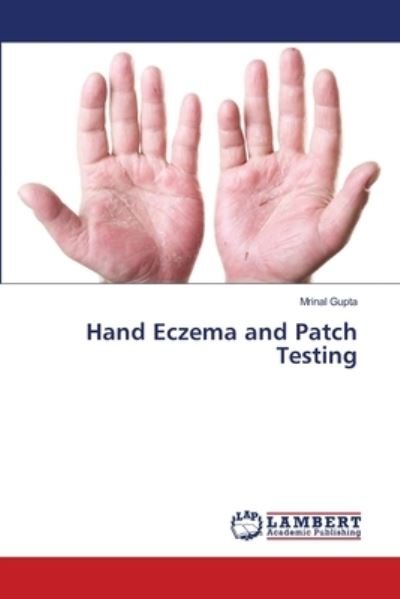 Cover for Gupta · Hand Eczema and Patch Testing (Book) (2018)