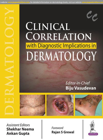 Cover for Biju Vasudevan · Clinical Correlation with Diagnostic Implications in Dermatology (Paperback Book) (2017)