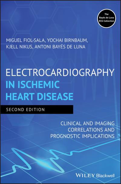 Cover for Miquel Fiol-Sala · Electrocardiography in Ischemic Heart Disease: Clinical and Imaging Correlations and Prognostic Implications (Gebundenes Buch) (2019)