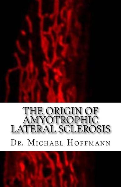 The Origin of Amyotrophic Lateral Sclerosis - Michael Hoffmann - Kirjat - Createspace Independent Publishing Platf - 9781519549662 - perjantai 27. marraskuuta 2015