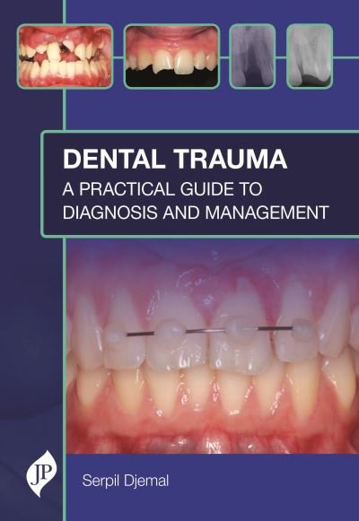 Cover for Serpil Djemal · Dental Trauma: A Practical Guide to Diagnosis and Management (Hardcover Book) (2021)