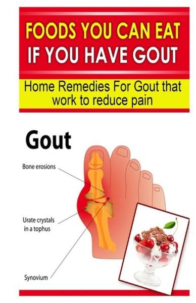 Cover for Doc Goodman · Foods You Can Eat if You Have Gout (Pocketbok) (2013)