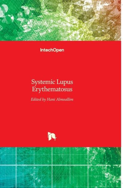 Cover for Hani Almoallim · Systemic Lupus Erythematosus (Hardcover Book) (2012)