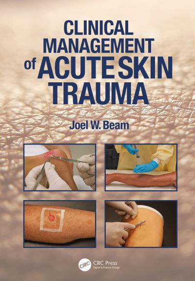 Clinical Management of Acute Skin Trauma - Joel W. Beam - Books - SLACK  Incorporated - 9781638220664 - July 11, 2024