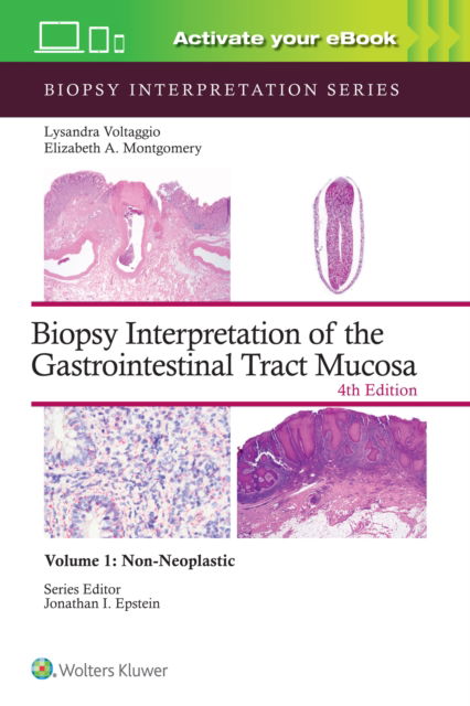 Cover for Lysandra Voltaggio · Biopsy Interpretation of the Gastrointestinal Tract Mucosa Volume 1: Non-Neoplastic: Print + eBook with Multimedia - Biopsy Interpretation Series (Hardcover Book) (2024)