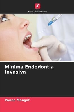 Cover for Panna Mangat · Minima Endodontia Invasiva (Paperback Book) (2021)