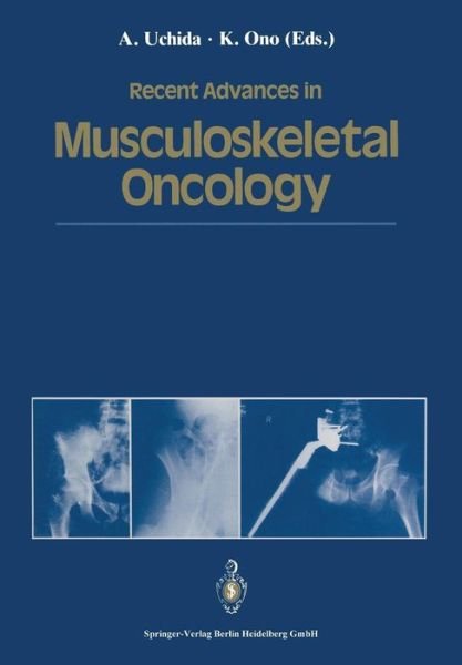 Atsumasa Uchida · Recent Advances in Musculoskeletal Oncology (Paperback Book) [Softcover reprint of the original 1st ed. 1992 edition] (2014)