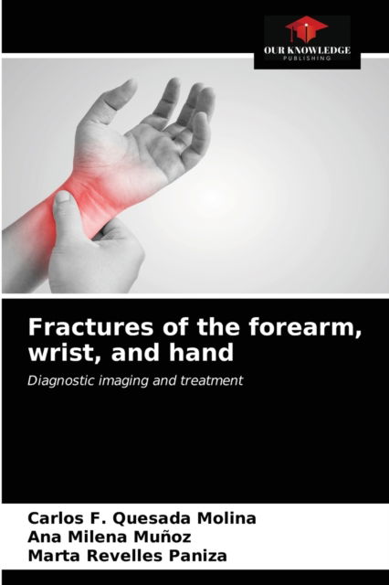 Cover for Carlos F Quesada Molina · Fractures of the forearm, wrist, and hand (Paperback Book) (2021)