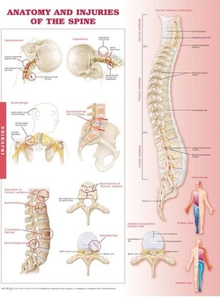 Cover for Anatomical Chart Company · Anatomy and Injuries of the Spine: Anatomical Chart (Landkarten) (2010)