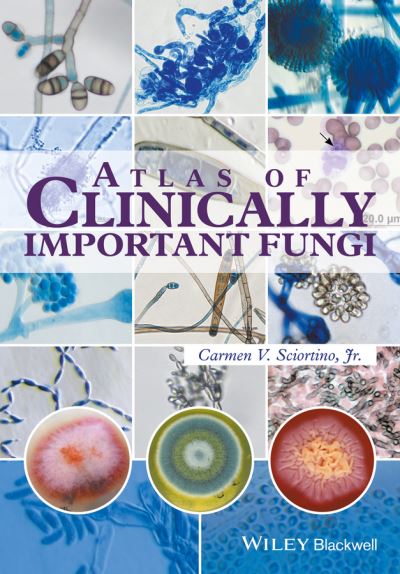 Cover for Sciortino, Carmen V., Jr. · Atlas of Clinically Important Fungi (Hardcover Book) (2017)