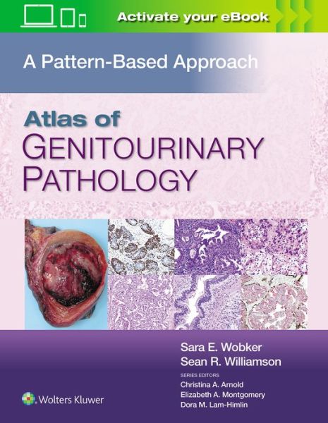 Cover for Wobker, Sara E., MD, MPH · Atlas of Genitourinary Pathology: A Pattern Based Approach (Hardcover Book) (2021)