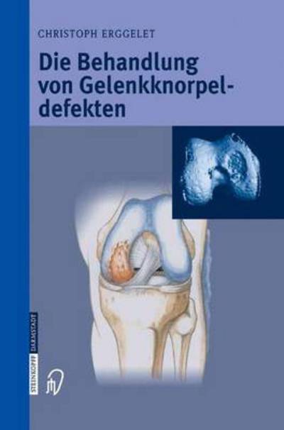 Cover for Christoph Erggelet · Die Behandlung Von Gelenkknorpeldefekten (Hardcover Book) [German, 1 edition] (2004)