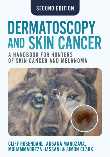 Cover for Cliff Rosendahl · Dermatoscopy and Skin Cancer, second edition: A handbook for hunters of skin cancer and melanoma (Paperback Book) (2025)