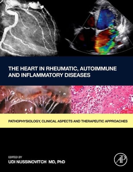 Cover for Udi Nussinovitch · The Heart in Rheumatic, Autoimmune and Inflammatory Diseases: Pathophysiology, Clinical Aspects and Therapeutic Approaches (Gebundenes Buch) (2017)