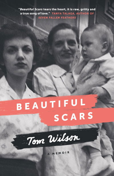 Cover for Tom Wilson · Beautiful Scars: Steeltown Secrets, Mohawk Skywalkers and the Road Home (Paperback Book) (2019)