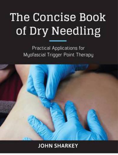 The Concise Book of Dry Needling: Practical Applications for Myofascial Trigger Point Therapy - John Sharkey - Books - Lotus Publishing Limited - 9781905367672 - November 30, 2016