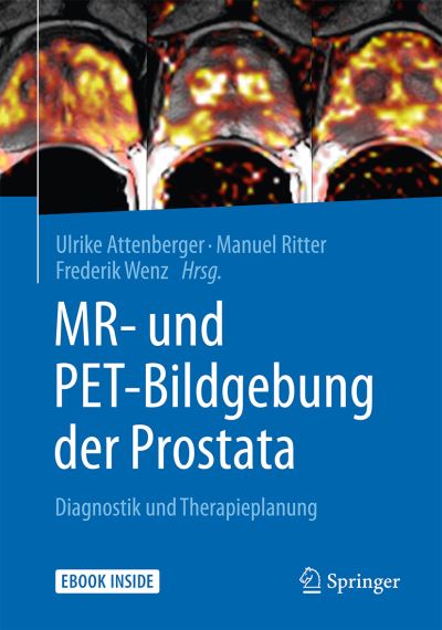 Cover for MR und PET Bildgebung der Prostata (Book) (2016)