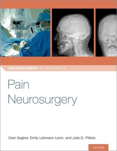 Cover for Pain Neurosurgery - Neurosurgery by Example (Paperback Book) (2019)