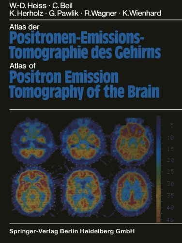Cover for W. D. Heiss · Atlas der Positronen-Emissions-Tomographie des Gehirns / Atlas of Positron Emission Tomography of the Brain (Paperback Book) [Softcover reprint of the original 1st ed. 1985 edition] (2011)
