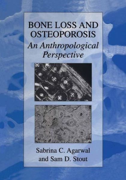 Cover for Sabrina C Agarwal · Bone Loss and Osteoporosis: An Anthropological Perspective (Hardcover Book) [2003 edition] (2003)