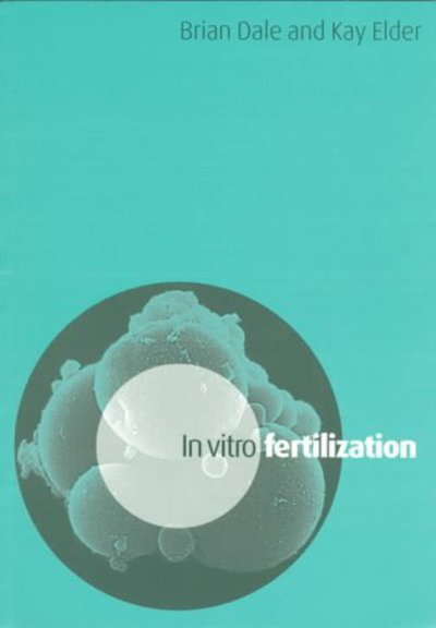 In Vitro Fertilization - Brian Dale - Kirjat - Cambridge University Press - 9780521575676 - torstai 26. kesäkuuta 1997