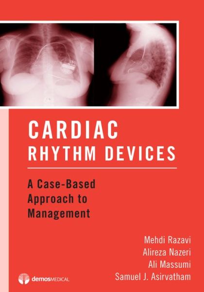 Cover for Mehdi Razavi · Cardiac Rhythm Devices: A Case-Based Approach to Management (Paperback Book) (2010)