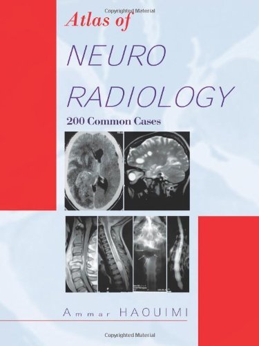 Cover for Ammar Haouimi · Atlas Of NEURORADIOLOGY: 200 Common Cases (Pocketbok) (2012)
