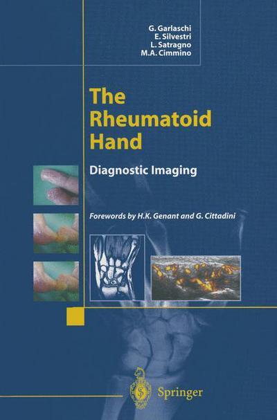 Cover for G. Garlaschi · The Rheumatoid Hand: Diagnostic Imaging (Pocketbok) [Softcover reprint of the original 1st ed. 2002 edition] (2012)