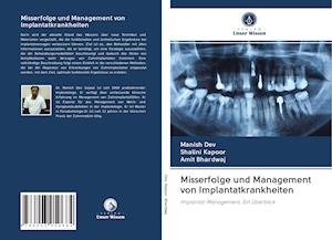 Cover for Dev · Misserfolge und Management von Impl (Book)