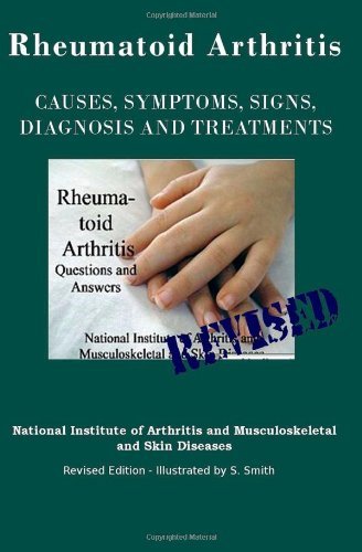 Rheumatoid Arthritis: Causes, Symptoms, Signs, Diagnosis and Treatments - Revised Edition - Illustrated by S. Smith - National Institute of Mental Health - Livros - CreateSpace Independent Publishing Platf - 9781469986685 - 2 de fevereiro de 2012