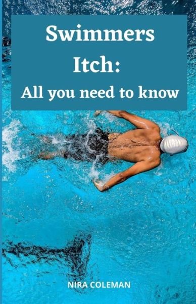 Cover for Nira Coleman · Swimmers Itch: All you need to know: What &amp;#1089; &amp;#1072; n be d&amp;#1086; n&amp;#1077; t&amp;#1086; reduce the r&amp;#1110; &amp;#1109; k &amp;#1086; f swimmer's itch? (Pocketbok) (2021)