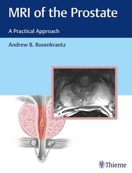 Cover for Rosenkrantz Andrew · MRI of the Prostate: A Practical Approach (Inbunden Bok) (2017)