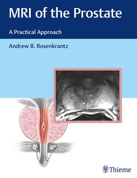 Cover for Rosenkrantz Andrew · MRI of the Prostate: A Practical Approach (Hardcover Book) (2017)